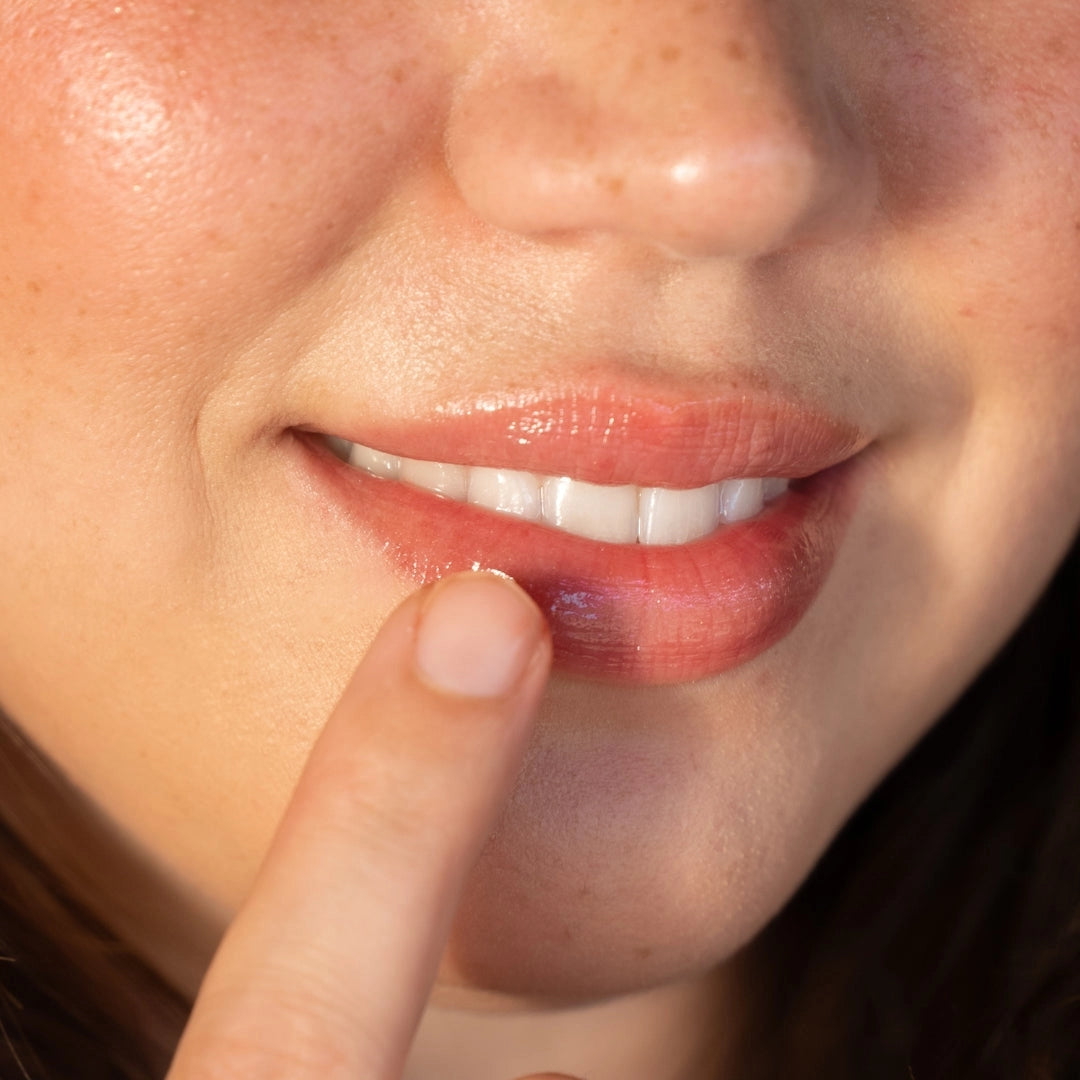 Close-up of a person's lips with a finger pointing to the mouth area